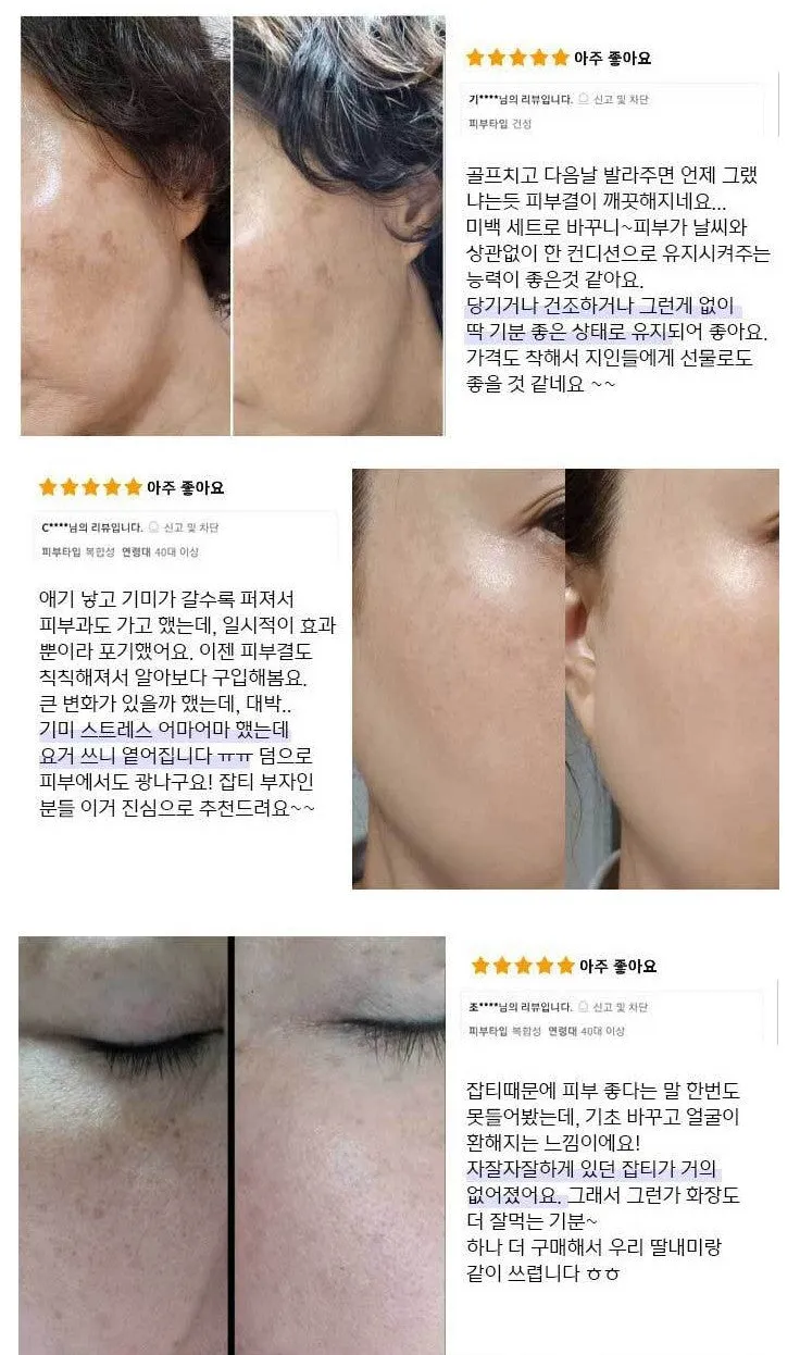 Anjo The White Skin care 6 Sets Signature Hyaluronic Blemish Glutathione Anti-ageing Wrinkles Dark Circles Finelines Gifts White