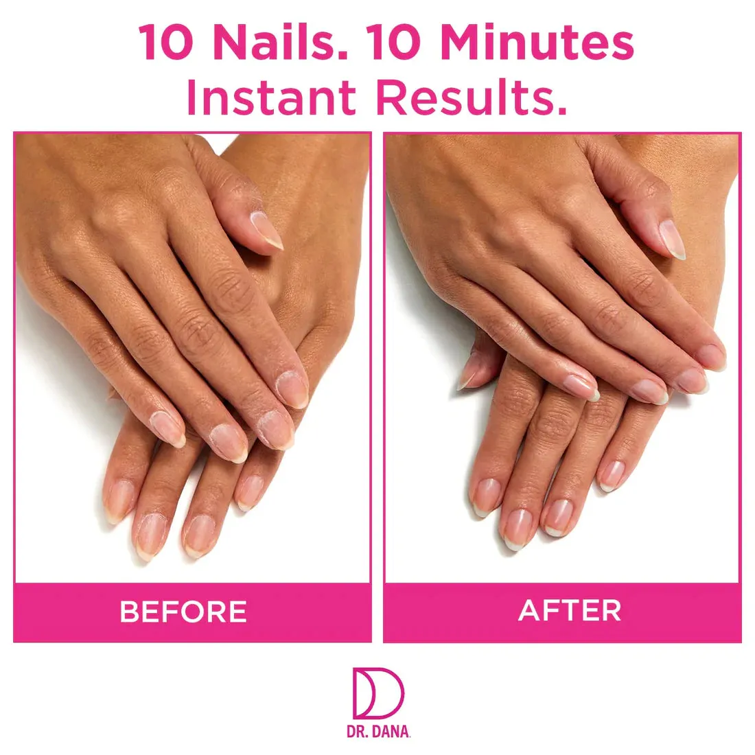 Dr. Dana Nail Renewal System